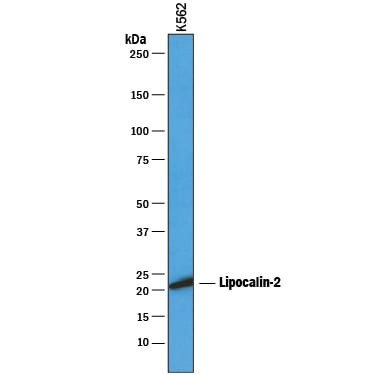 Detection of Human Lipocalin‑2/NGAL antibody by Western Blot.