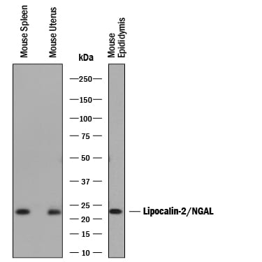 Detection of Mouse Lipocalin-2/NGAL antibody by Western Blot.
