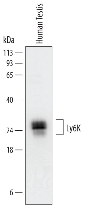 Detection of Human Ly6K antibody by Western Blot.