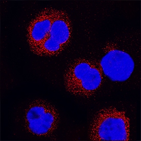 Lyn antibody in Raji Human Cell Line by Immunocytochemistry (ICC).