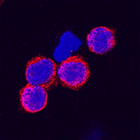 Lyp antibody in Human PBMCs by Immunocytochemistry (ICC).