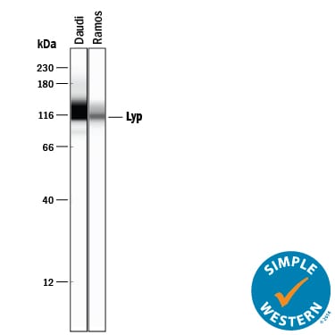 Detection of Human Lyp antibody by Simple WesternTM.