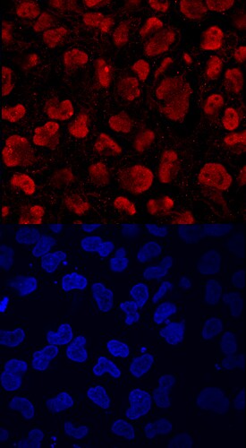 KDM4A antibody in BG01V Human Cell Line by Immunocytochemistry (ICC).