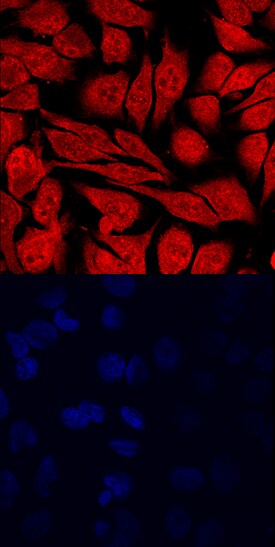 KDM4C antibody in HeLa Human Cell Line by Immunocytochemistry (ICC).