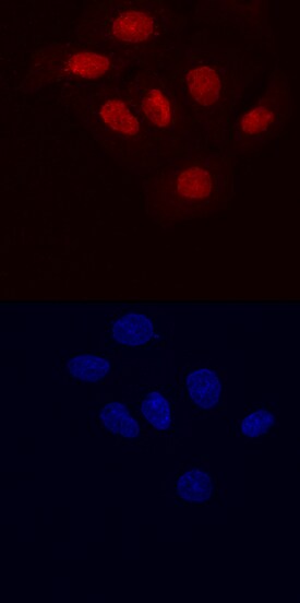Lysine (K)-specific Demethylase 5B/KDM5B antibody in BT-20 Human Cell Line by Immunocytochemistry (ICC).
