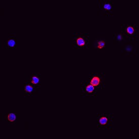 M-CSF R/CD115 antibody in Human PBMCs by Immunocytochemistry (ICC).