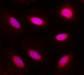 MAD2L1 antibody in A549 Human Cell Line by Immunocytochemistry (ICC).