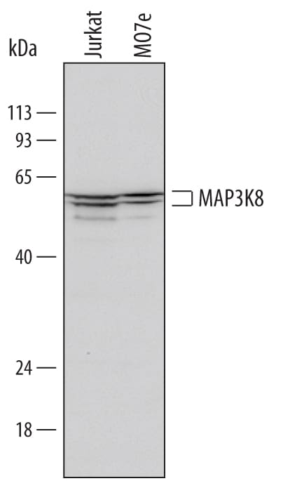 Detection of Human MAP3K8/Tpl2/COT antibody by Western Blot.