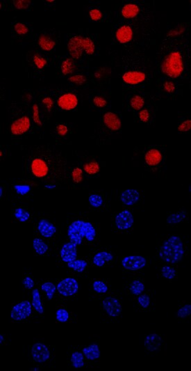 MARCH8 antibody in Human Dendritic Cells by Immunocytochemistry (ICC).
