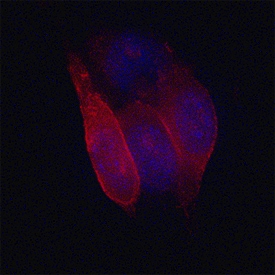 MCAM/CD146 antibody in B16-F1 Mouse Cell Line by Immunocytochemistry (ICC).