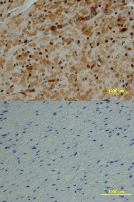 MCM2 antibody in Human Colon by Immunohistochemistry (IHC-P).