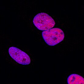 MCM7 antibody in HeLa Human Cell Line by Immunocytochemistry (ICC).