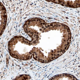 MED4 antibody in Human Prostate by Immunohistochemistry (IHC-P).