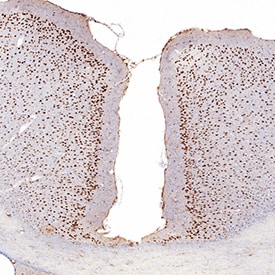 MEF2C antibody in Human Brain by Immunohistochemistry (IHC-P).