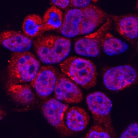 MEKK2 antibody in 293T Human Cell Line by Immunocytochemistry (ICC).