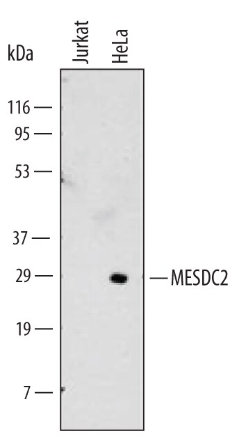 Detection of Human MESDC2 antibody by Western Blot.