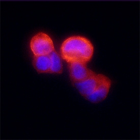 N-Acetylglucosaminyltransferase V/MGAT5 antibody in MCF-7 Human Cell Line by Immunocytochemistry (ICC).