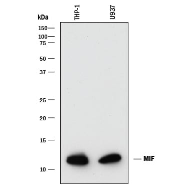 Detection of Human MIF antibody by Western Blot.