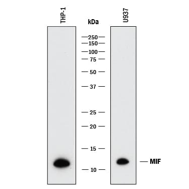 Detection of Human MIF antibody by Western Blot.