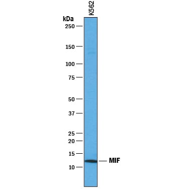 Detection of Human MIF antibody by Western Blot.