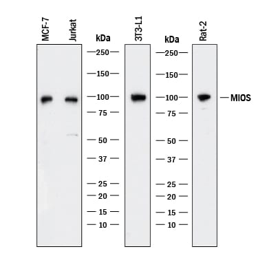 Detection of Human MIOS antibody by Western Blot.