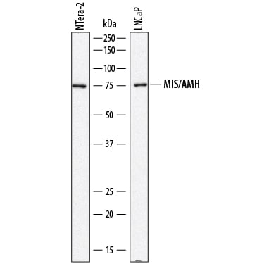Detection of Human MIS/AMH antibody by Western Blot.