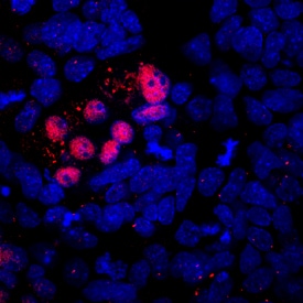 MIXL1 antibody in D3 Mouse Embryonic Stem Cells by Immunocytochemistry (ICC).