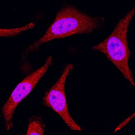 MKK3 antibody in HeLa Human Cell Line by Immunocytochemistry (ICC).