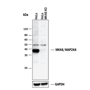 Western Blot Shows Human MKK6 Antibody Specificity by Using Knockout Cell Line.
