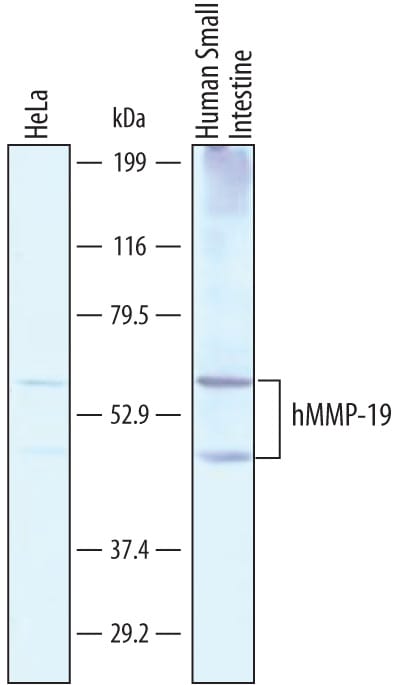 Detection of Human MMP-19 antibody by Western Blot.