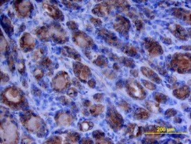 MMP-1 antibody in Human Prostate Tissue by Immunohistochemistry (IHC-P).