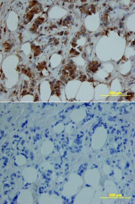 MMP-8 antibody in Human Breast by Immunohistochemistry (IHC-P).