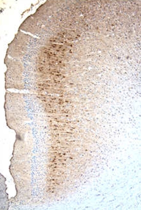 MMP‑9 antibody in Rat Brain by Immunohistochemistry (IHC-Fr).
