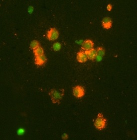 MMP‑9 antibody in NS0 Mouse Cell Line by Immunocytochemistry (ICC).