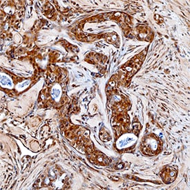 MMP-16/MT3-MMP antibody in Human Breast by Immunohistochemistry (IHC-P).