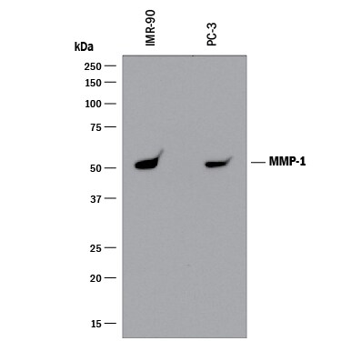 Detection of Human MMP-1 antibody by Western Blot.