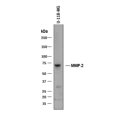 Detection of Human MMP‑2 antibody by Western Blot.