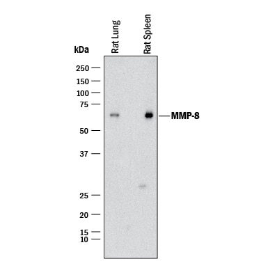 Detection of Rat MMP-8 antibody by Western Blot.