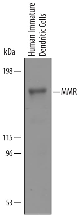 Detection of Human MMR/CD206 antibody by Western Blot.