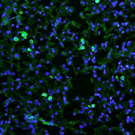 MMR/CD206 antibody in Mouse Lung by Immunohistochemistry (IHC-Fr).