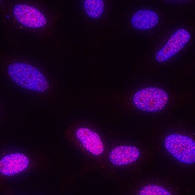 Phospho-MSK1(S376)/MSK2(S360) antibody in HeLa Human Cell Line by Immunocytochemistry (ICC).