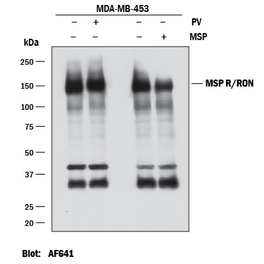 Detection of Human MSP R/Ron antibody by Western Blot.