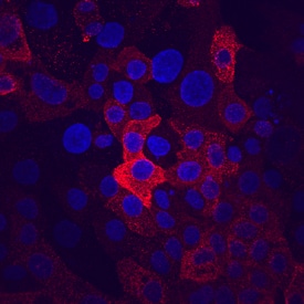 MUC-1 antibody in Capan-1 Human Cell Line by Immunocytochemistry (ICC).
