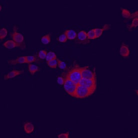 MUP-1 antibody in NCTC 1469 Mouse Cell Line by Immunocytochemistry (ICC).