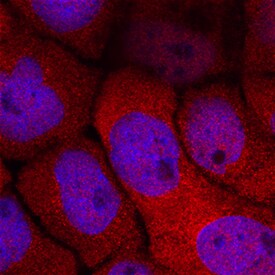 MVK antibody in A431 Human Cell Line by Immunocytochemistry (ICC).