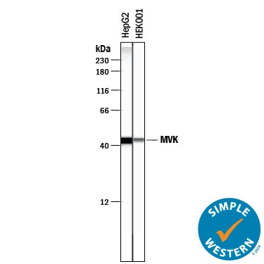 Detection of Human MVK antibody by Simple WesternTM.
