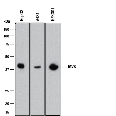 Detection of Human MVK antibody by Western Blot.