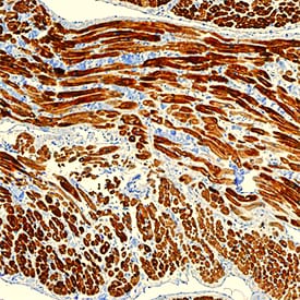 MYH6 antibody in Human Heart by Immunohistochemistry (IHC-P).