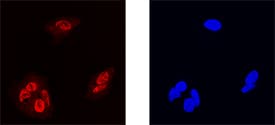 MafF antibody in HepG2 Human Cell Line by Immunocytochemistry (ICC).