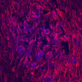 Matrilin-1 antibody in Human Mesenchymal Stem Cells by Immunocytochemistry (ICC).